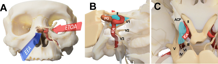Approach Endoscopic Endonasal Approach — Figure 1