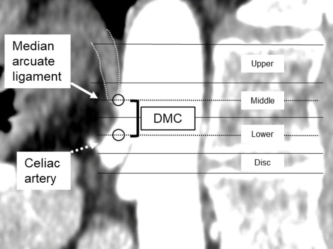 Adult Spinal Deformity Correction — Figure 3.