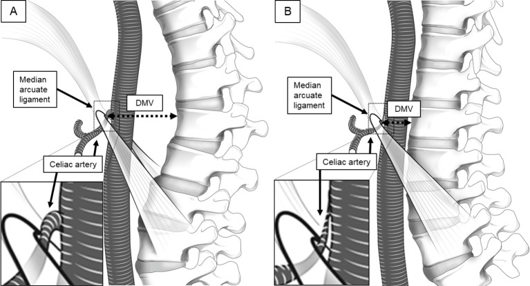 Adult Spinal Deformity Correction — Figure 6.