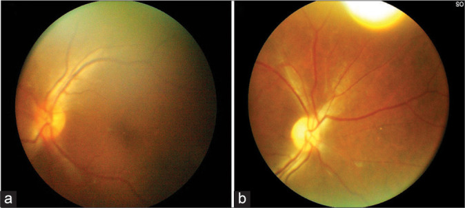 Anterior Communicating Artery Aneurysm Clipping — Figure 4: