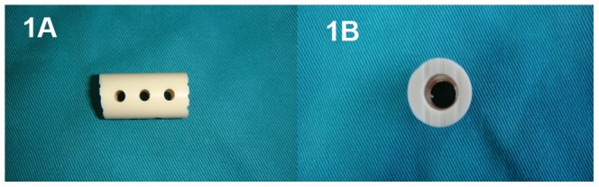 Anterior Thoracic Corpectomy Reconstruction — Figure 1