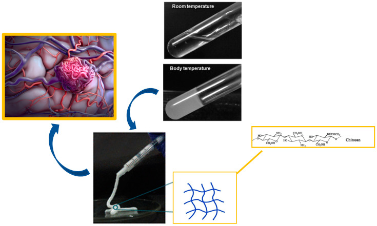 AVM dAVF Endovascular Embolization — Figure 3