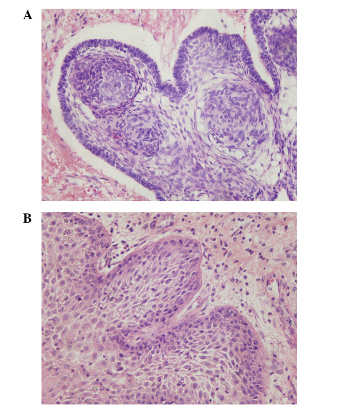 Craniopharyngioma Resection — Figure 1