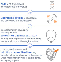 Craniosynostosis Repair — Figure 1
