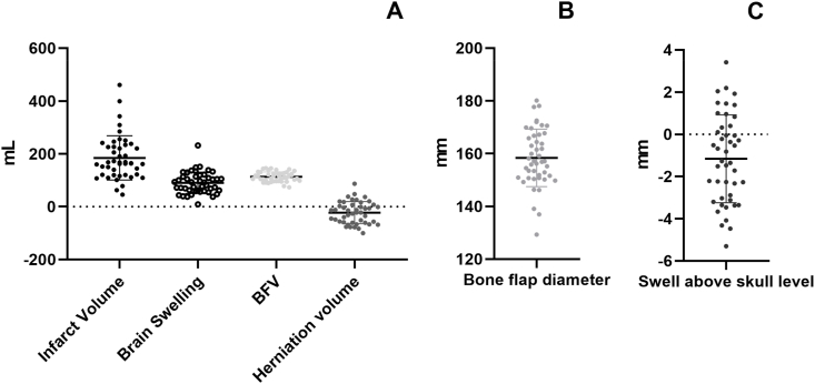 Decompressive Hemicraniectomy Malignant MCA Infarction — Fig. 4