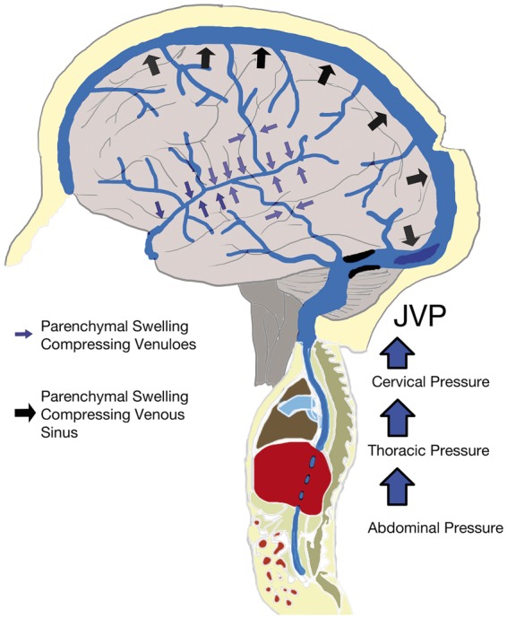 Depressed Skull Fracture Elevation — Figure 7.