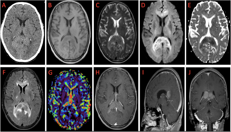 Frame-Based Stereotactic Brain Biopsy — Figure 1