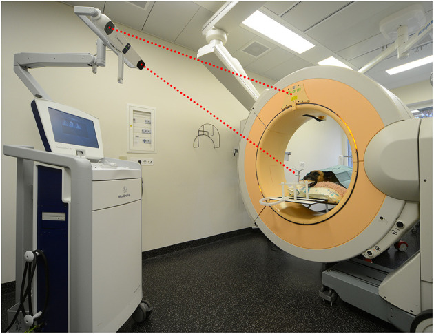 Frameless Stereotactic Brain Biopsy — Figure 1