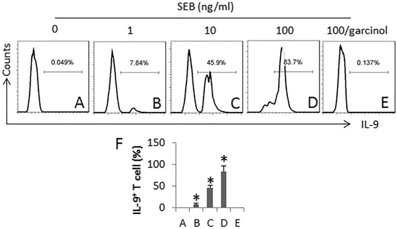 Glioma Resection — Figure 4