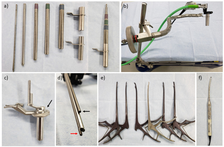 Lumbar Laminectomy Spinal Stenosis — Figure 1