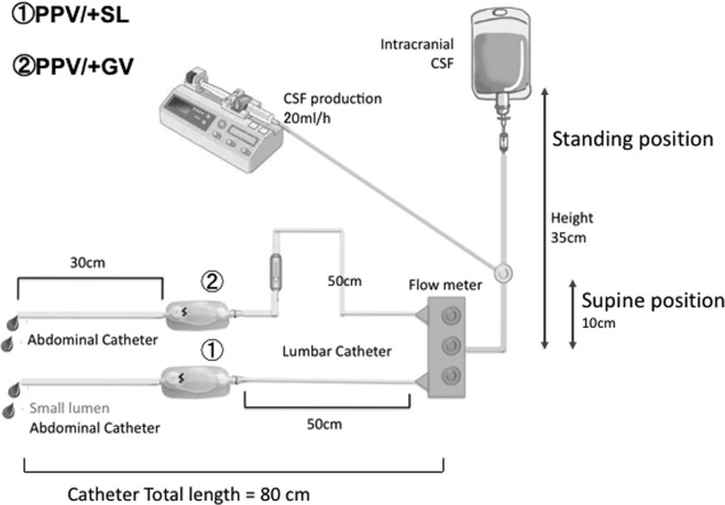 Lumboperitoneal Shunt Placement — FIGURE 1.