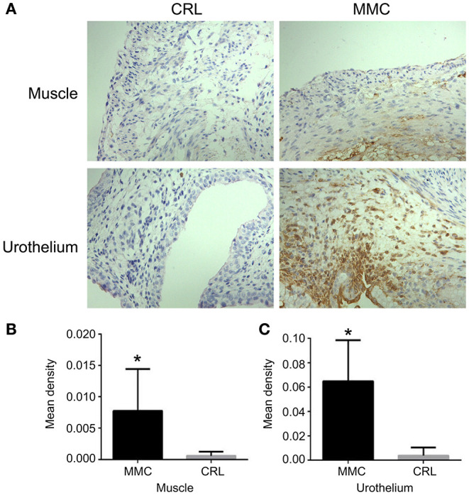 Myelomeningocele Repair — Figure 3