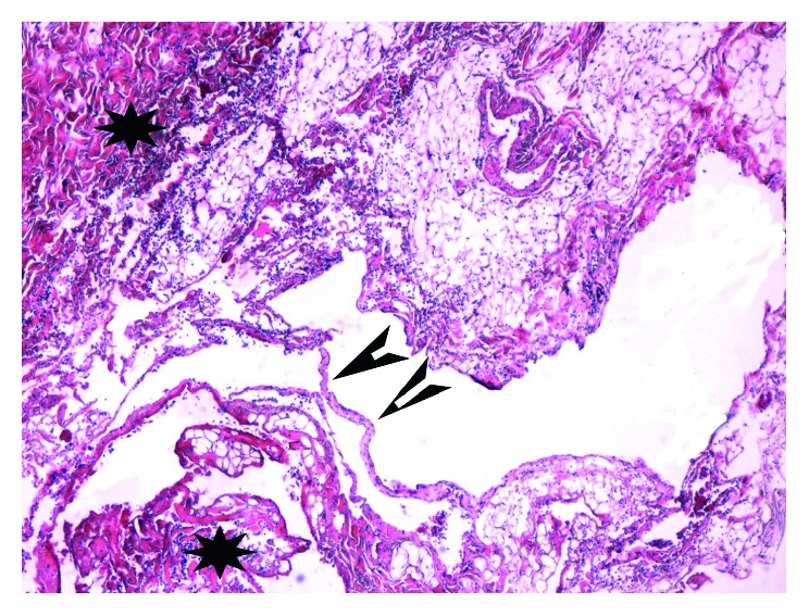 Occipitocervical Fusion — Figure 2