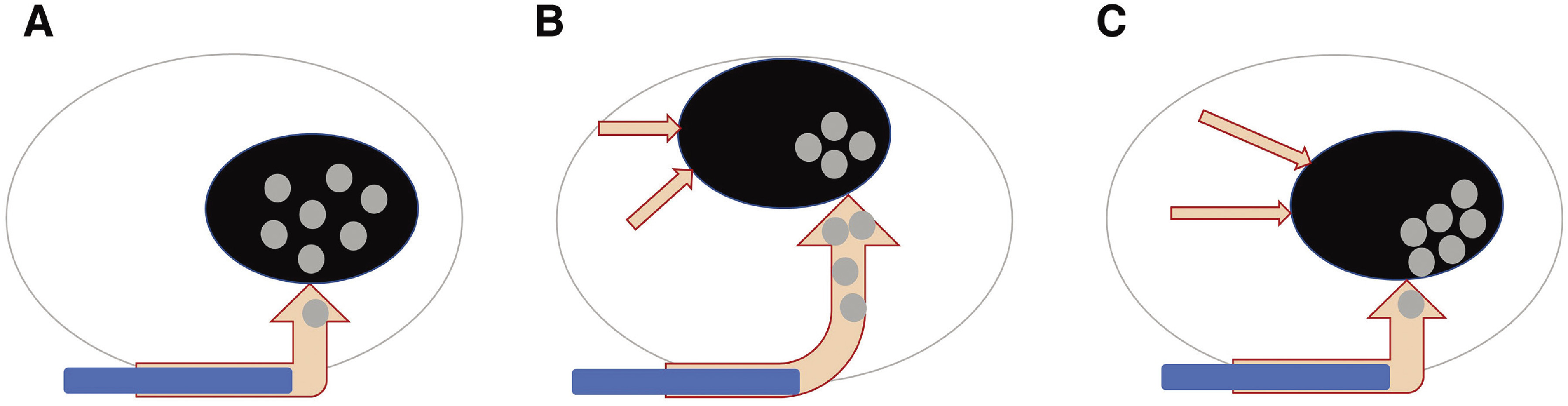 Parasagittal Falx Meningioma Resection — Fig. 2
