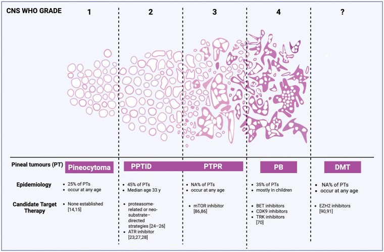 Pineal Region Tumor Resection — Figure 3.