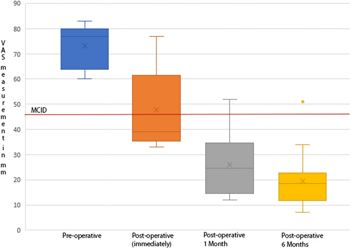 Posterior Cervical Foraminotomy — Figure 8