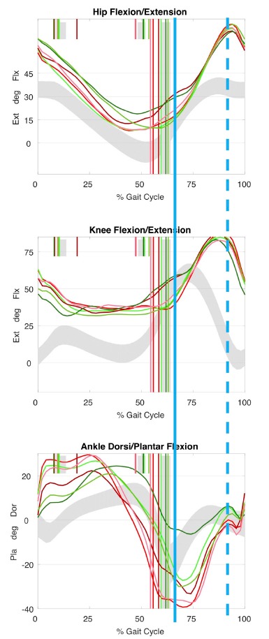 Selective Dorsal Rhizotomy — Fig. 3