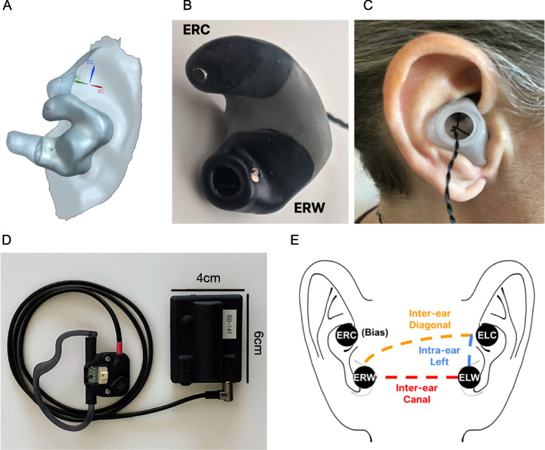 Stereo-EEG Depth Electrode Placement — Fig. 1