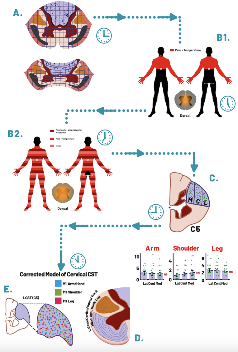 Traumatic Central Cord Syndrome — Fig. 1