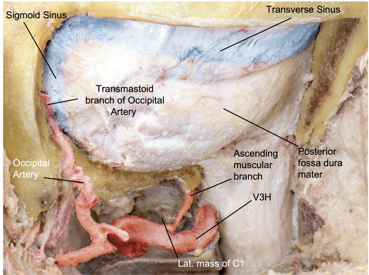 Anterior Cervical Approach — Figure 7