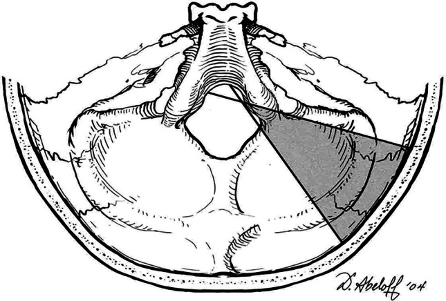 Posterior Cervical Approach — Fig. 1