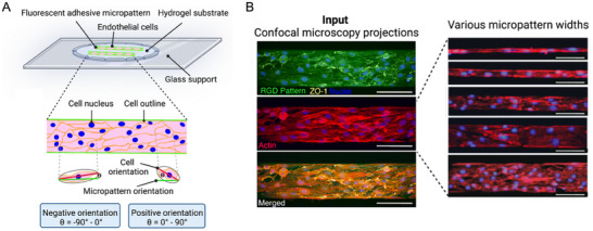 Reference Brain Biopsy Systems Stereotactic Platforms — Figure 5