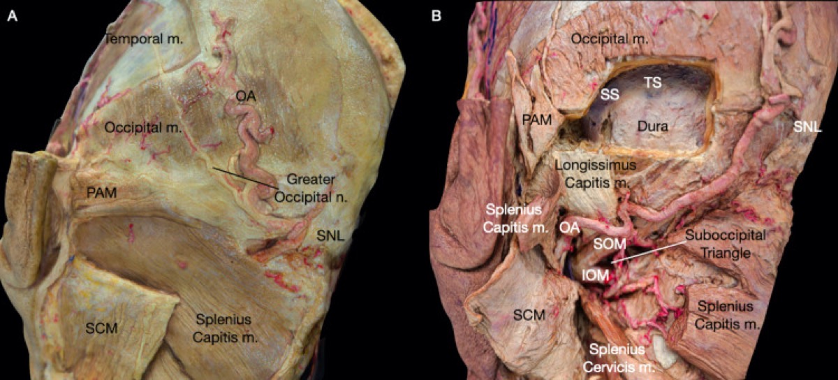Postauricular myofascial and deep muscle layers relevant to the retrosigmoid exposure